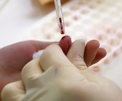 Какой анализ крови на сахар точнее: из пальца или из вены?
